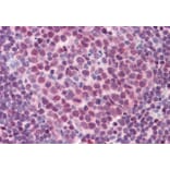 Immunohistochemistry - Anti-PU.1/Spi1 Antibody (A83352) - Antibodies.com