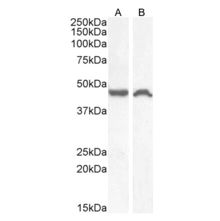 Western Blot - Anti-NK-1R Antibody (A83353) - Antibodies.com