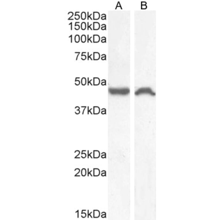 Western Blot - Anti-NK-1R Antibody (A83353) - Antibodies.com