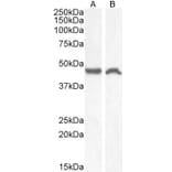 Western Blot - Anti-NK-1R Antibody (A83353) - Antibodies.com