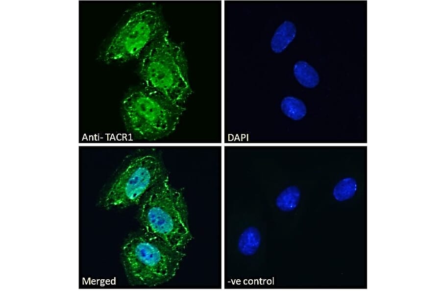 Immunofluorescence - Anti-NK-1R Antibody (A83353) - Antibodies.com