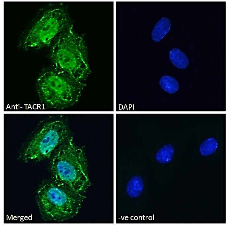 Immunofluorescence - Anti-NK-1R Antibody (A83353) - Antibodies.com