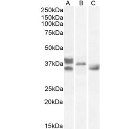 Western Blot - Anti-Renalase Antibody (A83355) - Antibodies.com