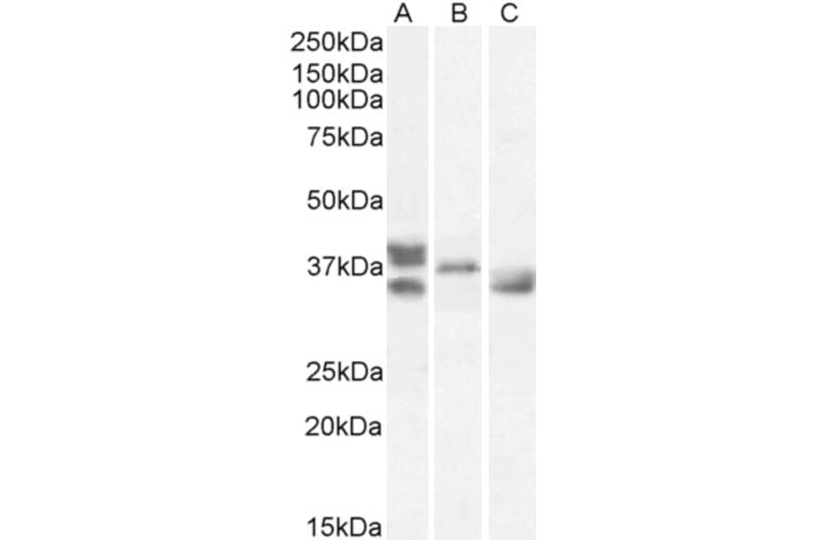 Western Blot - Anti-Renalase Antibody (A83355) - Antibodies.com
