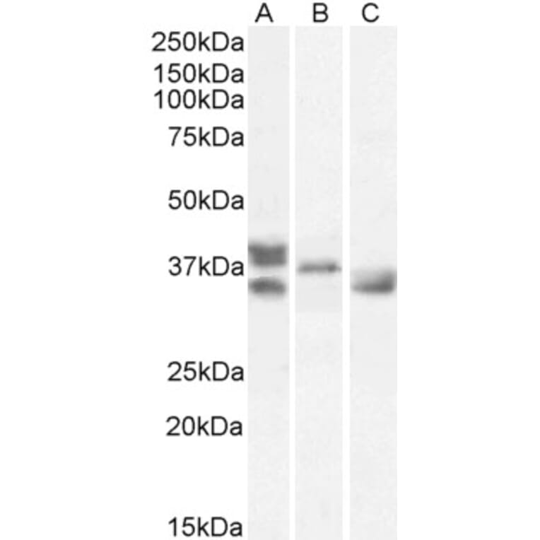Western Blot - Anti-Renalase Antibody (A83355) - Antibodies.com