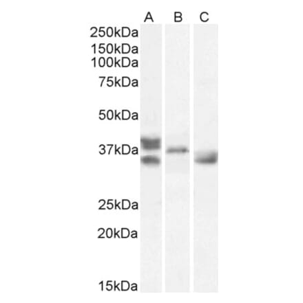 Western Blot - Anti-RNLS Antibody (A83355) - Antibodies.com