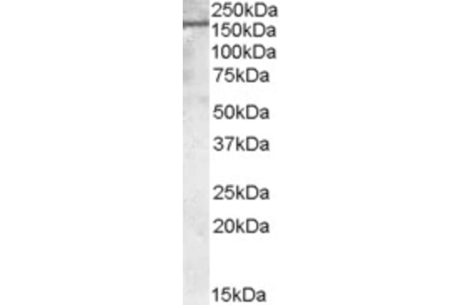 Western Blot - Anti-PODXL Antibody (A83356) - Antibodies.com