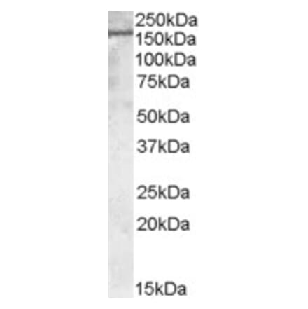 Western Blot - Anti-PODXL Antibody (A83356) - Antibodies.com