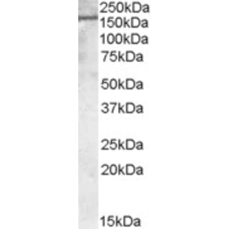Western Blot - Anti-PODXL Antibody (A83356) - Antibodies.com