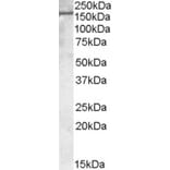 Western Blot - Anti-PODXL Antibody (A83356) - Antibodies.com