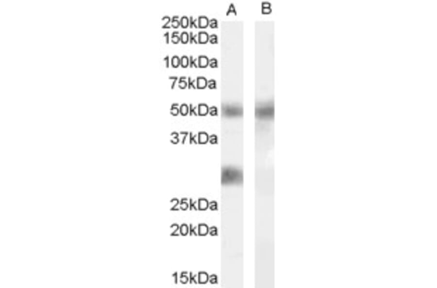 Western Blot - Anti-IGFBP3 Antibody (A83357) - Antibodies.com