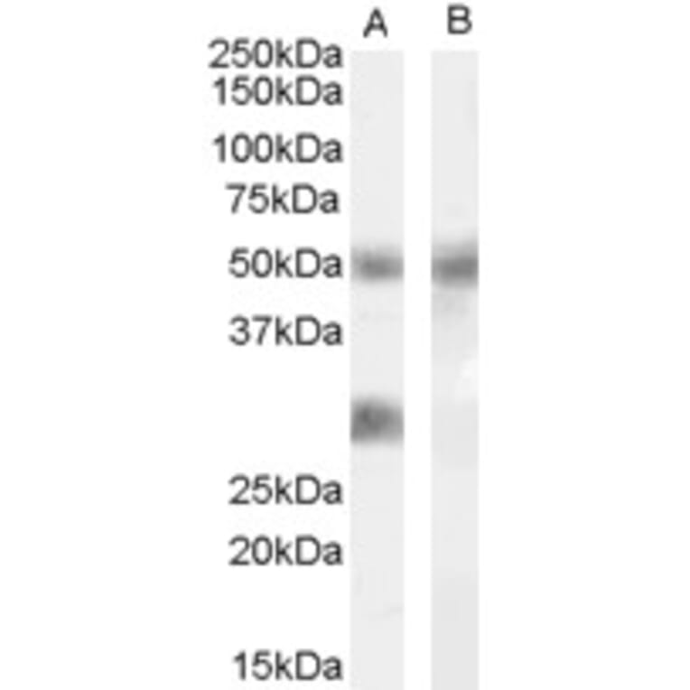 Western Blot - Anti-IGFBP3 Antibody (A83357) - Antibodies.com