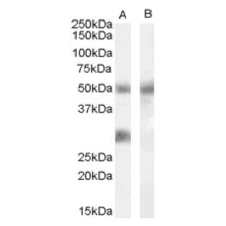 Western Blot - Anti-IGFBP3 Antibody (A83357) - Antibodies.com