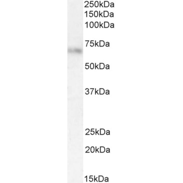 Western Blot - Anti-alpha 2 Antiplasmin Antibody (A83359) - Antibodies.com