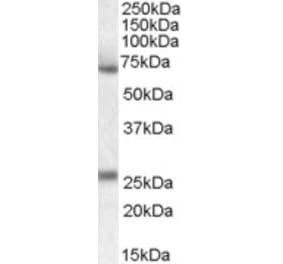 Western Blot - Anti-SERPINF2 Antibody (A83359) - Antibodies.com