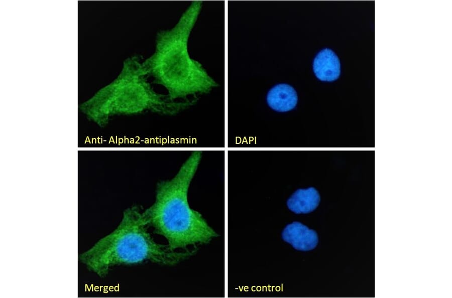 Immunofluorescence - Anti-alpha 2 Antiplasmin Antibody (A83359) - Antibodies.com