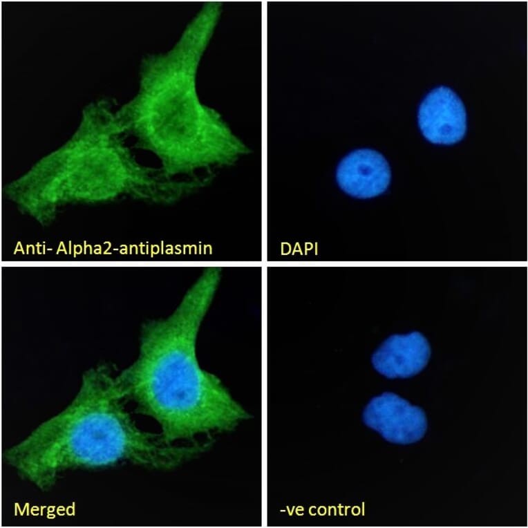 Immunofluorescence - Anti-alpha 2 Antiplasmin Antibody (A83359) - Antibodies.com