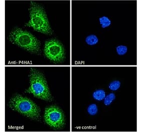 Immunofluorescence - Anti-P4HA1 Antibody (A83360) - Antibodies.com