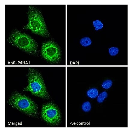 Immunofluorescence - Anti-P4HA1 Antibody (A83360) - Antibodies.com