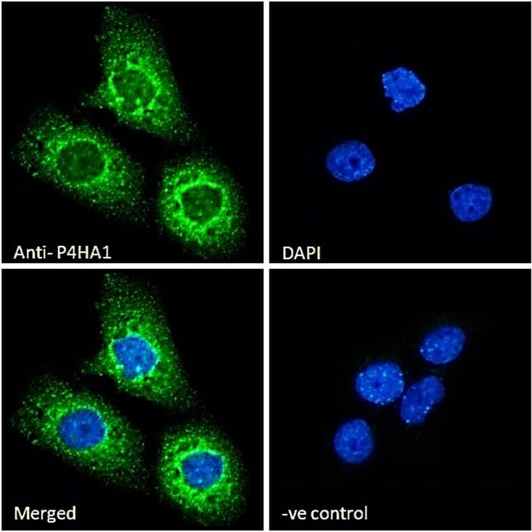 Immunofluorescence - Anti-P4HA1 Antibody (A83360) - Antibodies.com