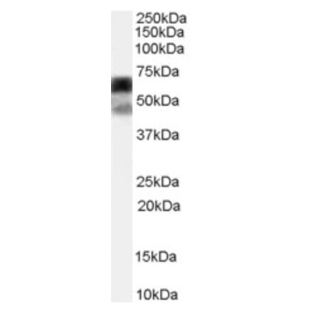 Western Blot - Anti-P4HA1 Antibody (A83360) - Antibodies.com