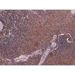 Immunohistochemistry - Anti-P4HA1 Antibody (A83360) - Antibodies.com