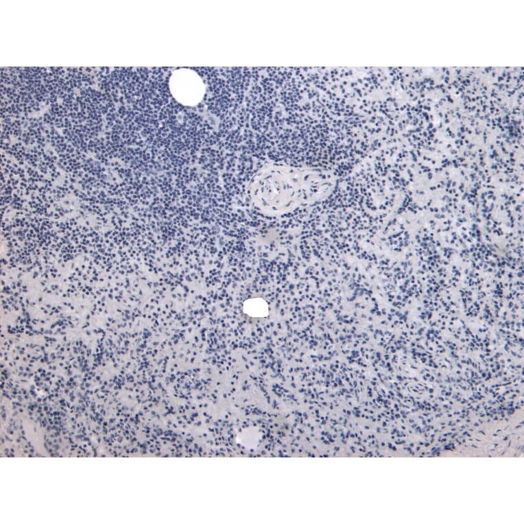 Immunohistochemistry - Anti-P4HA1 Antibody (A83360) - Antibodies.com