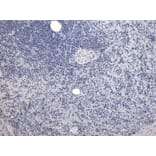 Immunohistochemistry - Anti-P4HA1 Antibody (A83360) - Antibodies.com