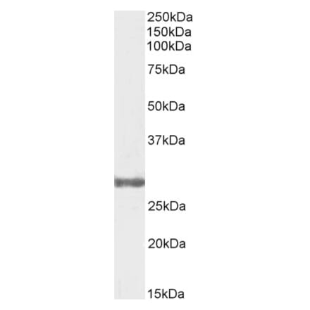 Western Blot - Anti-COMT Antibody (A83361) - Antibodies.com