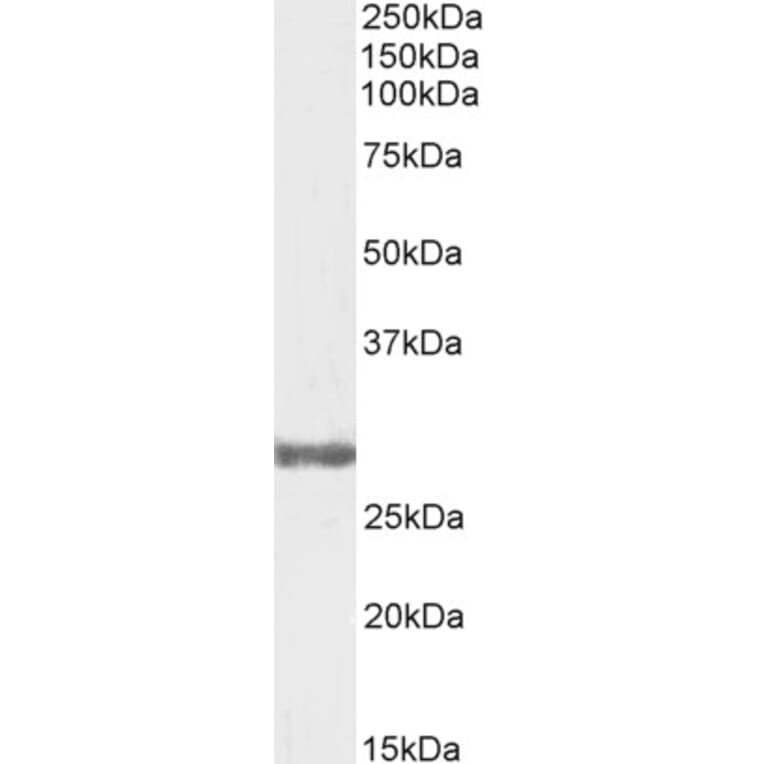 Western Blot - Anti-COMT Antibody (A83361) - Antibodies.com