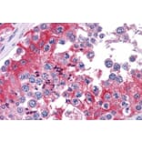 Immunohistochemistry - Anti-COMT Antibody (A83361) - Antibodies.com