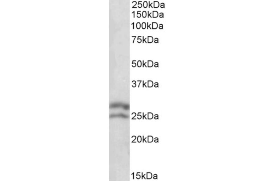 Western Blot - Anti-Bcl-2 Antibody (A83362) - Antibodies.com