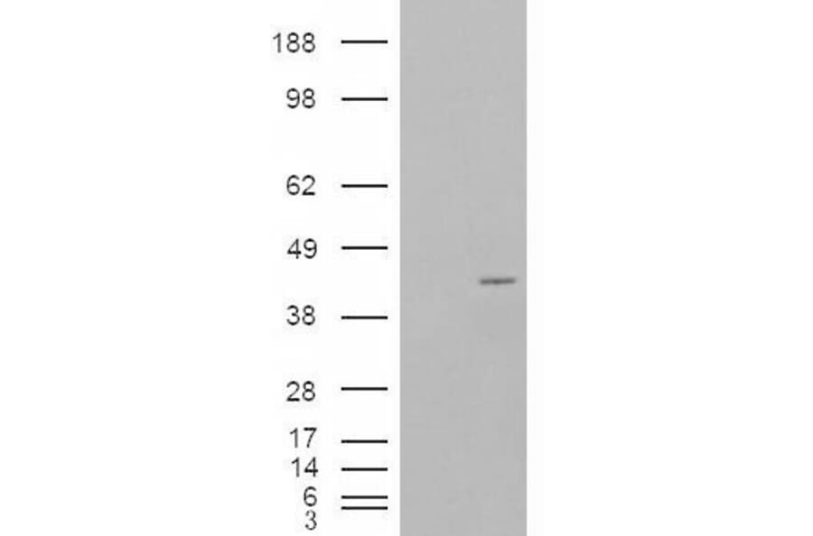 Western Blot - Anti-p40-phox Antibody (A83363) - Antibodies.com