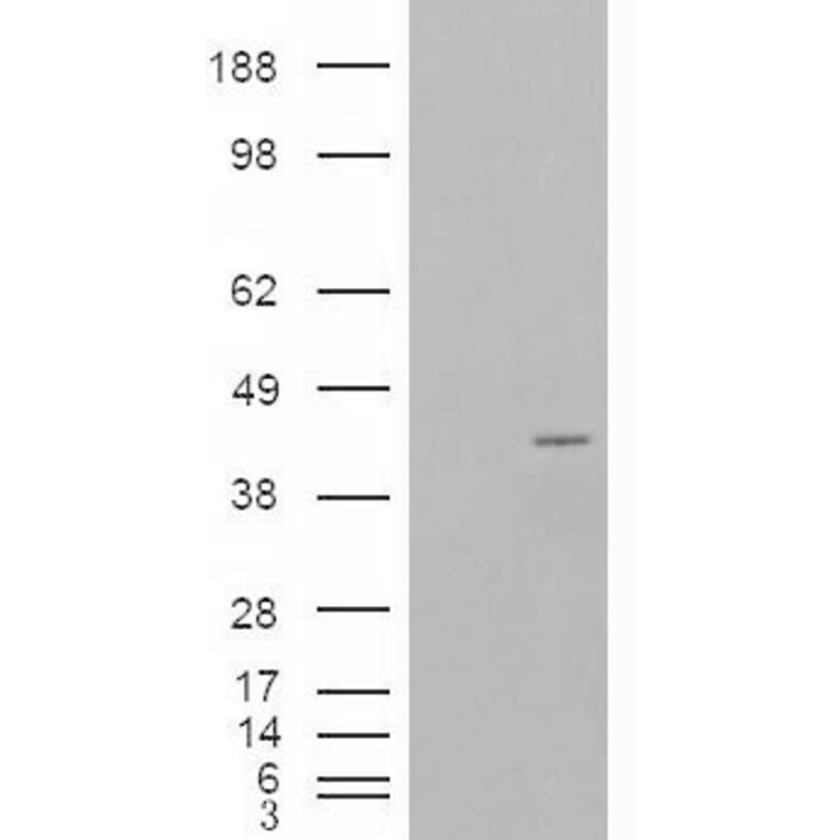 Western Blot - Anti-p40-phox Antibody (A83363) - Antibodies.com