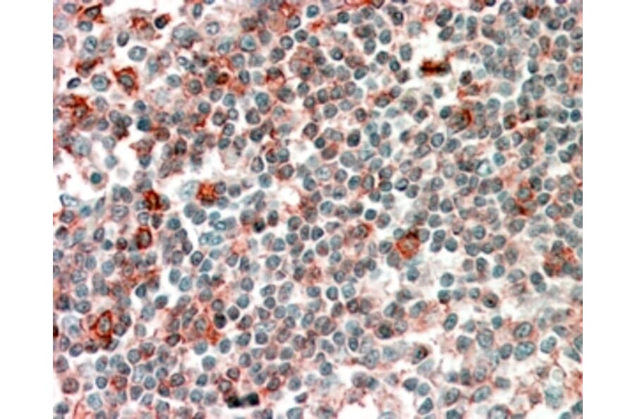 Immunohistochemistry - Anti-p40-phox Antibody (A83363) - Antibodies.com