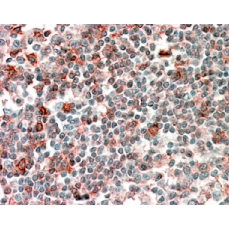 Immunohistochemistry - Anti-p40-phox Antibody (A83363) - Antibodies.com