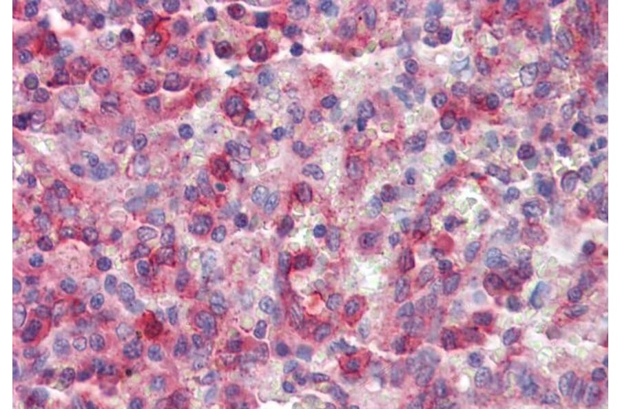 Immunohistochemistry - Anti-p40-phox Antibody (A83363) - Antibodies.com