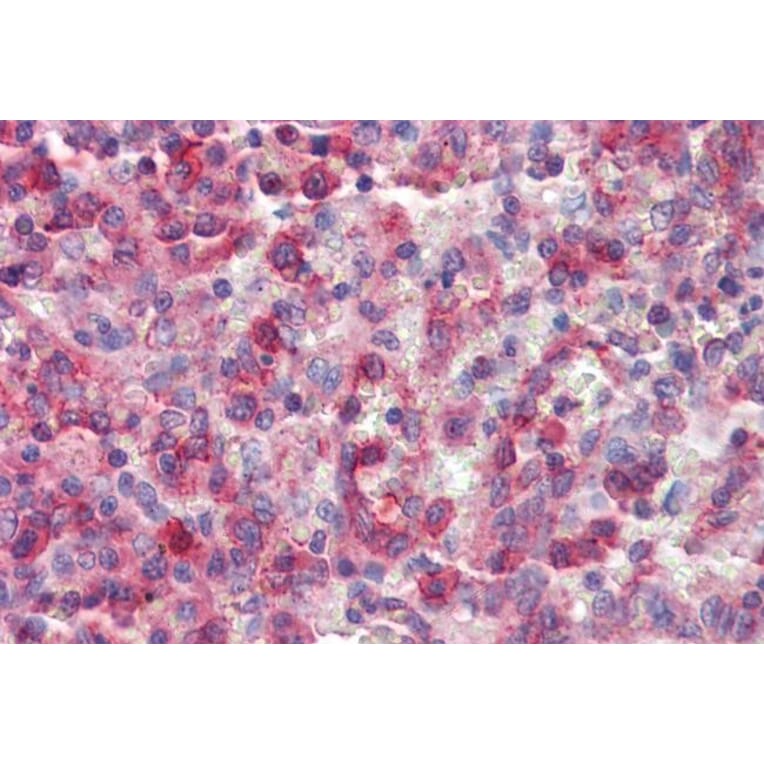 Immunohistochemistry - Anti-p40-phox Antibody (A83363) - Antibodies.com