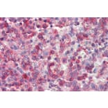 Immunohistochemistry - Anti-p40-phox Antibody (A83363) - Antibodies.com