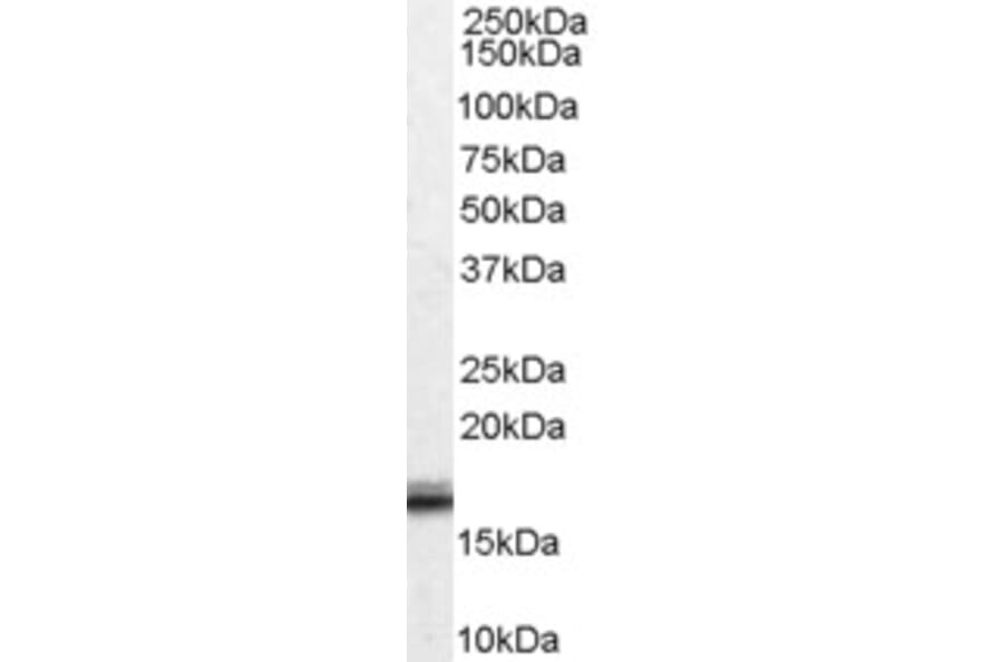 Western Blot - Anti-Von Hippel Lindau/VHL Antibody (A83364) - Antibodies.com