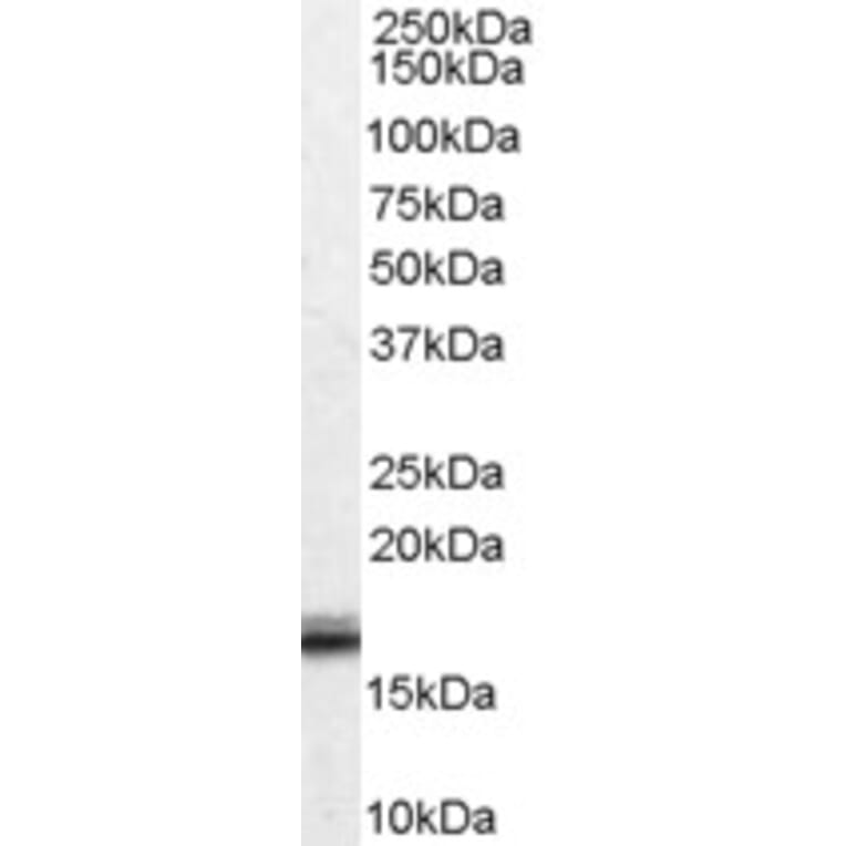 Western Blot - Anti-Von Hippel Lindau/VHL Antibody (A83364) - Antibodies.com