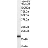 Western Blot - Anti-Von Hippel Lindau/VHL Antibody (A83364) - Antibodies.com