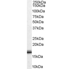 Western Blot - Anti-VHL Antibody (A83364) - Antibodies.com