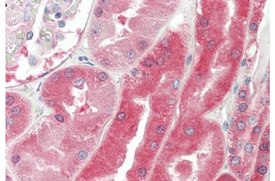Immunohistochemistry - Anti-Von Hippel Lindau/VHL Antibody (A83364) - Antibodies.com