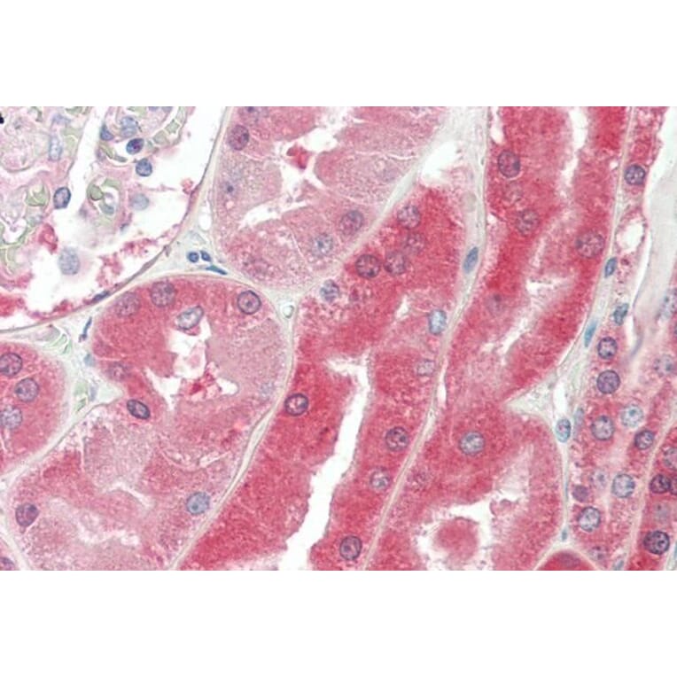 Immunohistochemistry - Anti-Von Hippel Lindau/VHL Antibody (A83364) - Antibodies.com