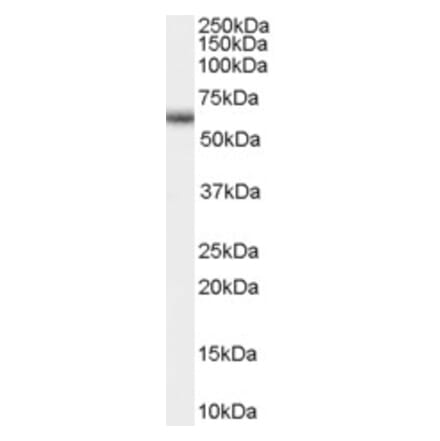 Western Blot - Anti-GnRHR Antibody (A83366) - Antibodies.com