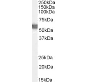 Western Blot - Anti-Glucose 6 Phosphate Dehydrogenase Antibody (A83368) - Antibodies.com