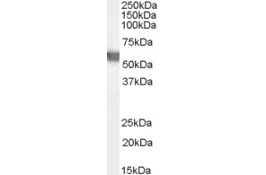 Western Blot - Anti-Glucose 6 Phosphate Dehydrogenase Antibody (A83368) - Antibodies.com