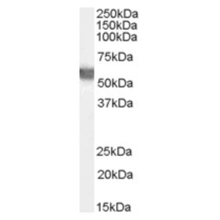 Western Blot - Anti-Glucose 6 Phosphate Dehydrogenase Antibody (A83368) - Antibodies.com