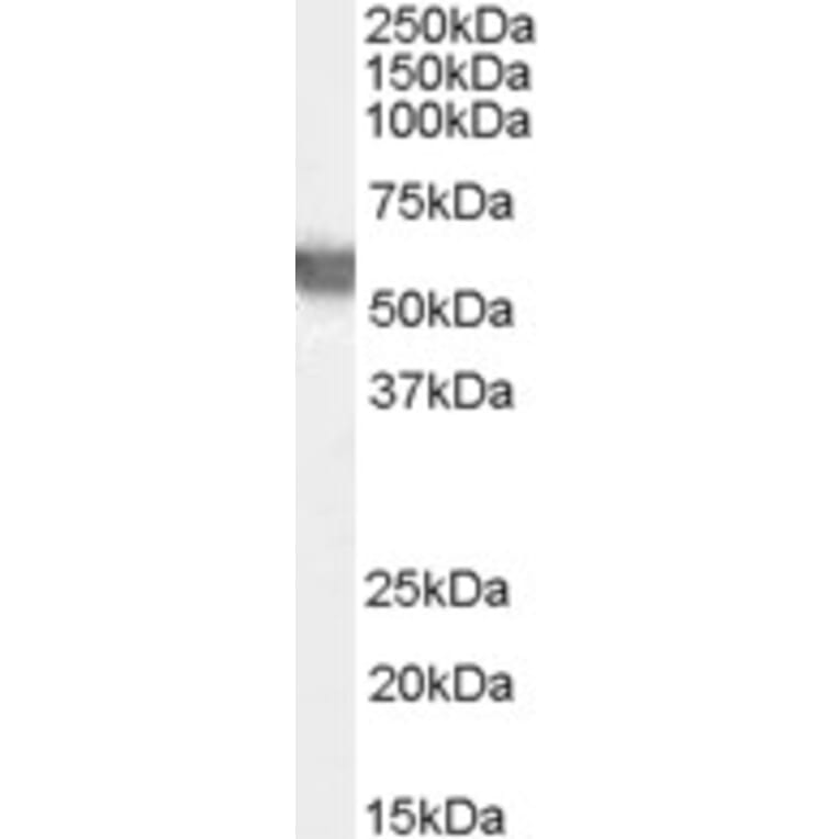 Western Blot - Anti-Glucose 6 Phosphate Dehydrogenase Antibody (A83368) - Antibodies.com